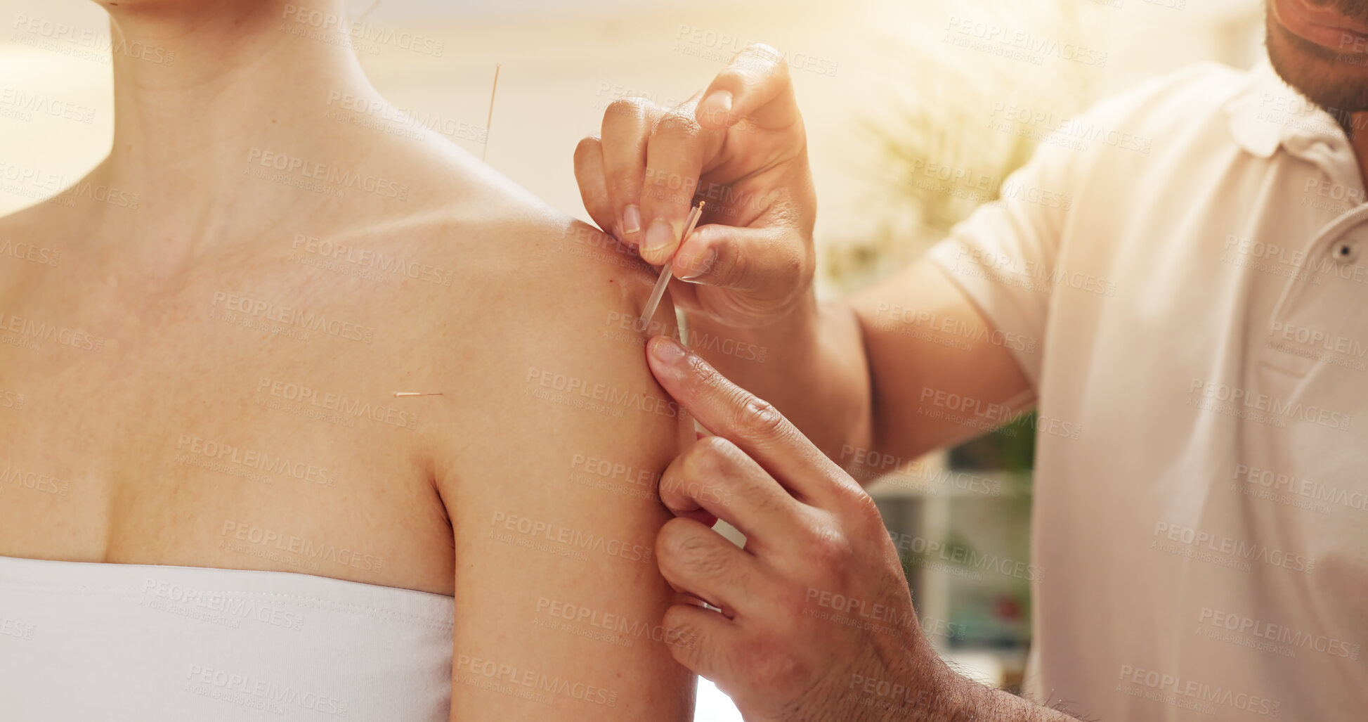 Buy stock photo Acupuncture, holistic and shoulder in spa with customer treatment for healing, stress relief or therapy. Body, hands and relax with masseuse in resort or resort for cosmetics, massage and skincare