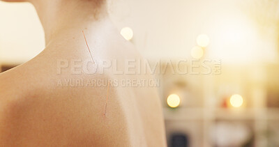 Buy stock photo Back, massage and person with needles for acupuncture closeup for health, wellness and relax at spa. Skin, treatment and alternative medicine with pin for traditional therapy or healing pain in salon