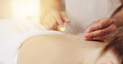 Buy stock photo Acupuncture, hands and stress relief in spa with customer for healing, holistic therapy or to relax. Body, dry needling and treatment with masseuse in resort for cosmetics, massage and skincare