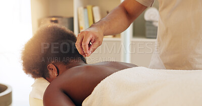 Buy stock photo Acupuncture, back and skincare in spa with customer treatment for healing, stress relief or therapy. Body, dry needling and hand of masseuse with client in resort for cosmetics or holistic massage