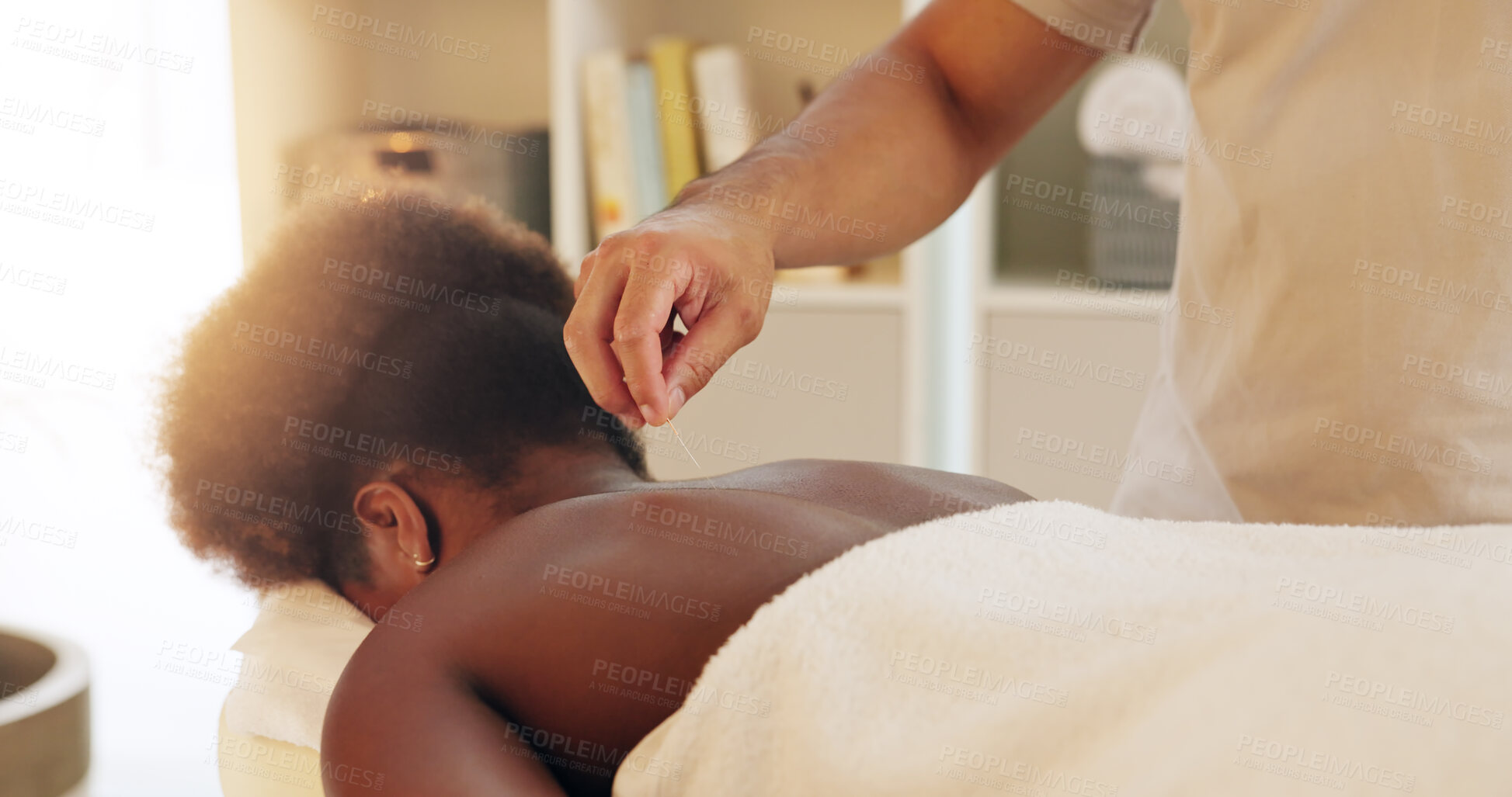 Buy stock photo Acupuncture, back and skincare in spa with customer treatment for healing, stress relief or therapy. Body, dry needling and hand of masseuse with client in resort for cosmetics or holistic massage