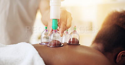 Buy stock photo Cupping, therapy and woman at spa to relax for back pain, healing or holistic treatment. Calm, wellness and hands of chiropractor with female patient for massage with glass acupuncture jars in clinic