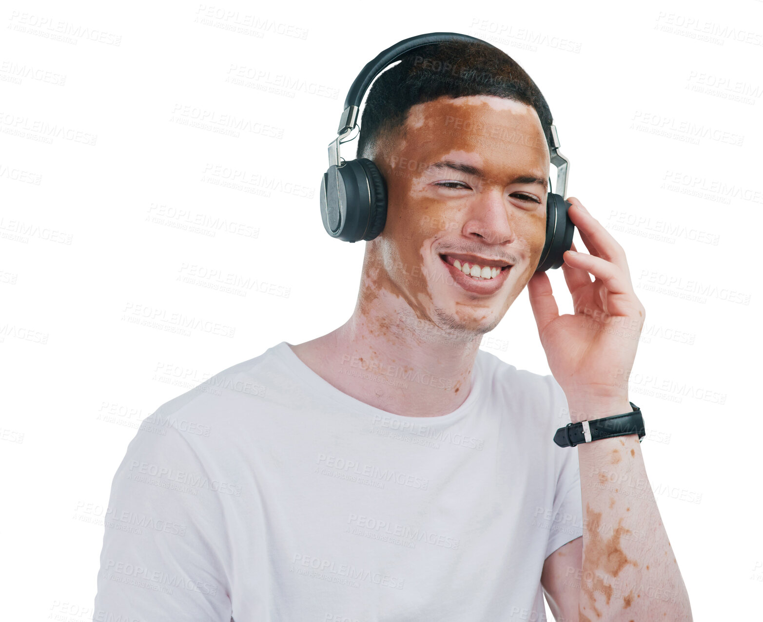 Buy stock photo Happy man, portrait and vitiligo with headphones for music isolated on a transparent PNG background. Face of male person with skin pigmentation and headset for listening to podcast, audio or sound