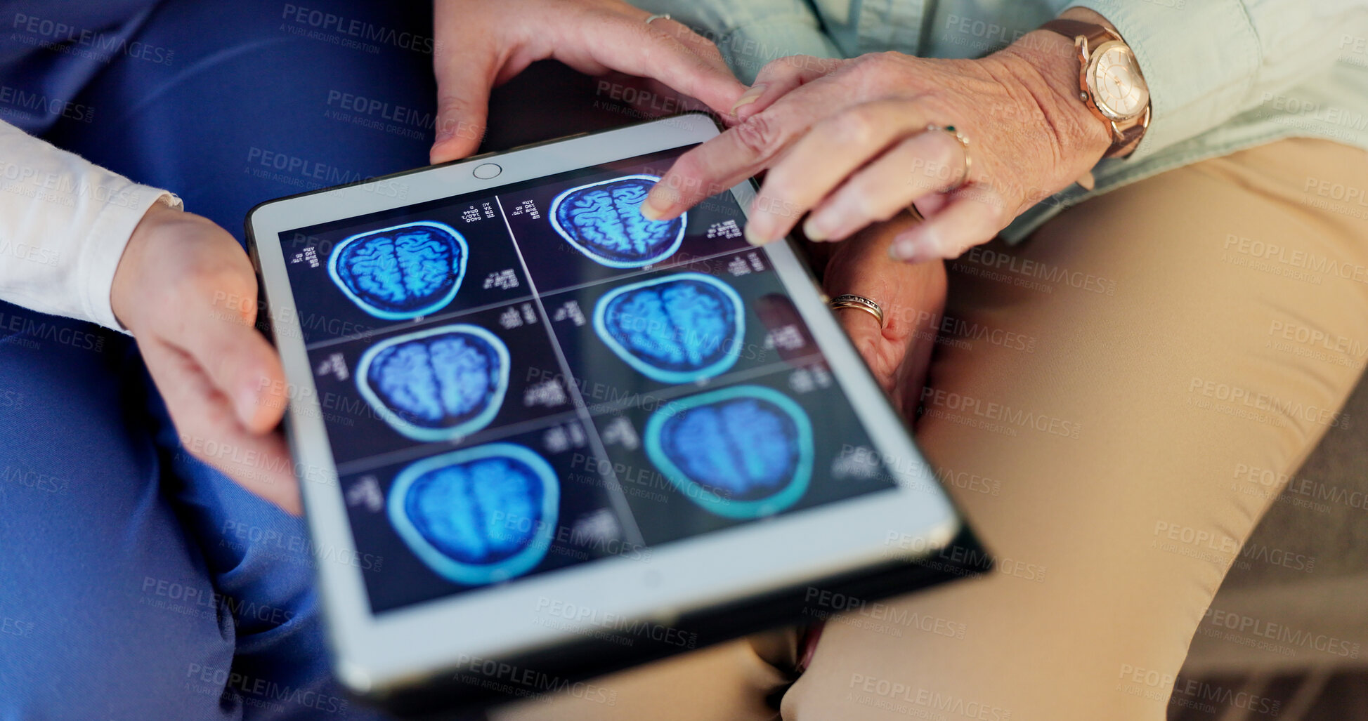 Buy stock photo Hands, nurse and patient with tablet, brain scan and healthcare with results for MRI x ray, diagnosis and tech. Closeup, doctor and person with tumor risk, cancer genome and neuroscience with expert