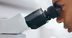 Medical, research and person with microscope, science and check experiment for monkeypox treatment. Biotech, sample or scientist with lab equipment, testing and cure development for bacteria or study