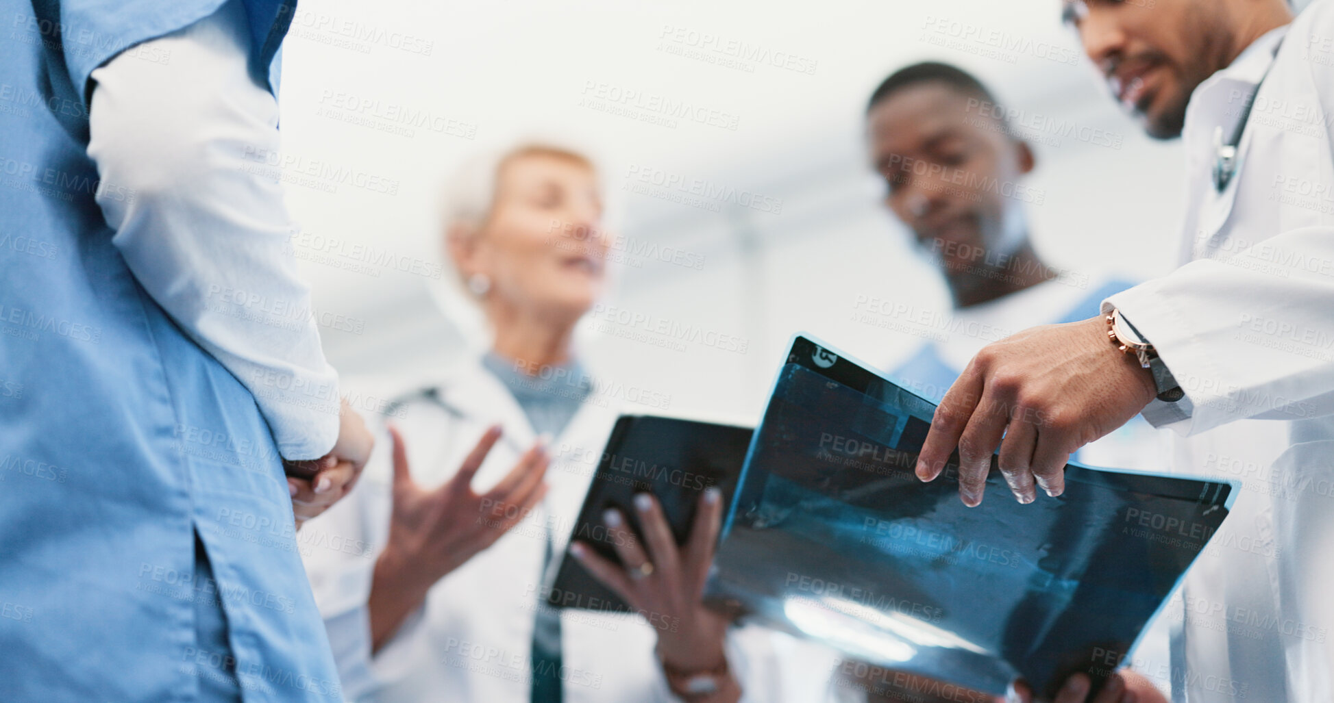 Buy stock photo Doctors, x ray and nurse discussion in hospital, professional consultation and teamwork collaboration for patient results. Radiologist, diagnosis and conversation with people, wellness and healthcare