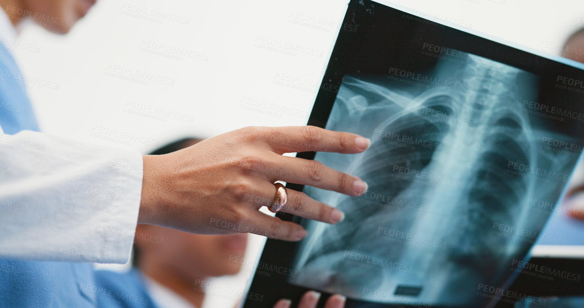 Buy stock photo Nurse, hands and x ray analysis in hospital, professional consultation and teamwork collaboration for medical results. Radiology, film and examine respiratory system, diagnosis and people discussion