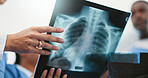 Nurse, hands and xray analysis in hospital, professional consultation and teamwork collaboration for patient results. Radiology, film and examine respiratory system, diagnosis and people discussion