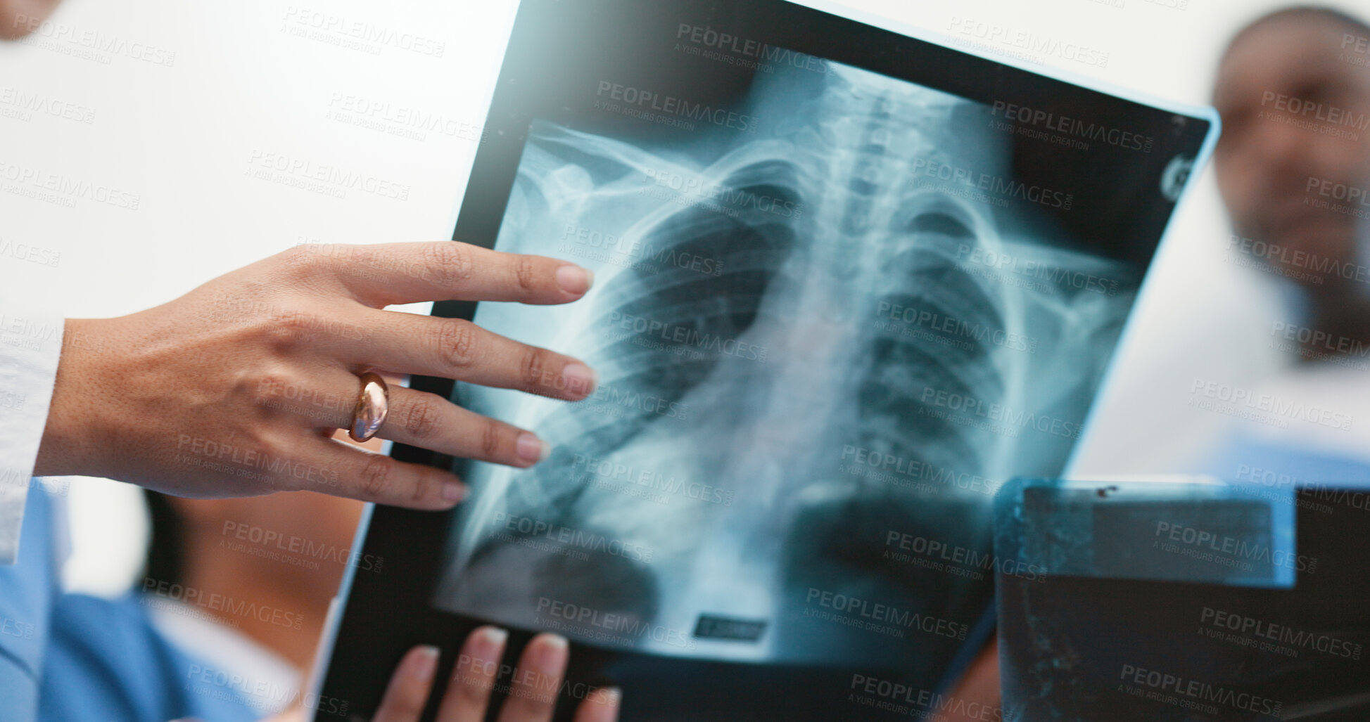 Buy stock photo Nurse, hands and xray analysis in hospital, professional consultation and teamwork collaboration for patient results. Radiology, film and examine respiratory system, diagnosis and people discussion