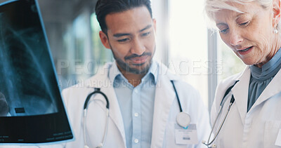 Buy stock photo Doctors, x ray and professional analysis in hospital, consultation and teamwork collaboration for patient results. Mature radiologist, film and examine for diagnosis, people and wellness discussion