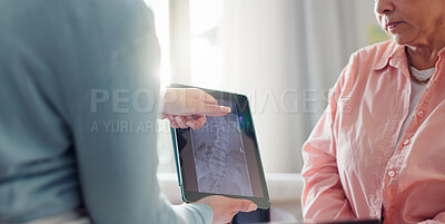 Buy stock photo Tablet, consulting and doctor with patient scan for medical service, evaluation and online results. Healthcare, chiropractor and people on digital tech for research, wellness and x ray of spine