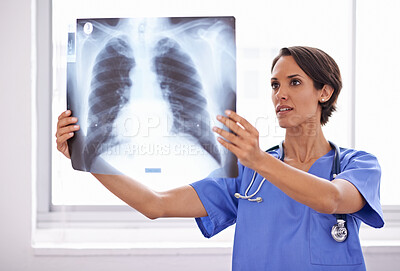 Buy stock photo X ray, hospital and woman doctor thinking of healthcare research, problem solving and review of skeleton and lung problem. Radiology professional, medical worker or surgeon with analysis or checking