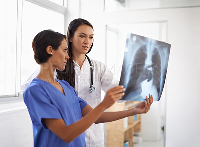 Buy stock photo Radiology, x ray or doctors with results in hospital, medical facility or clinic for lung exam or health. Women, people or healthcare workers with document, research or analysis of respiratory system