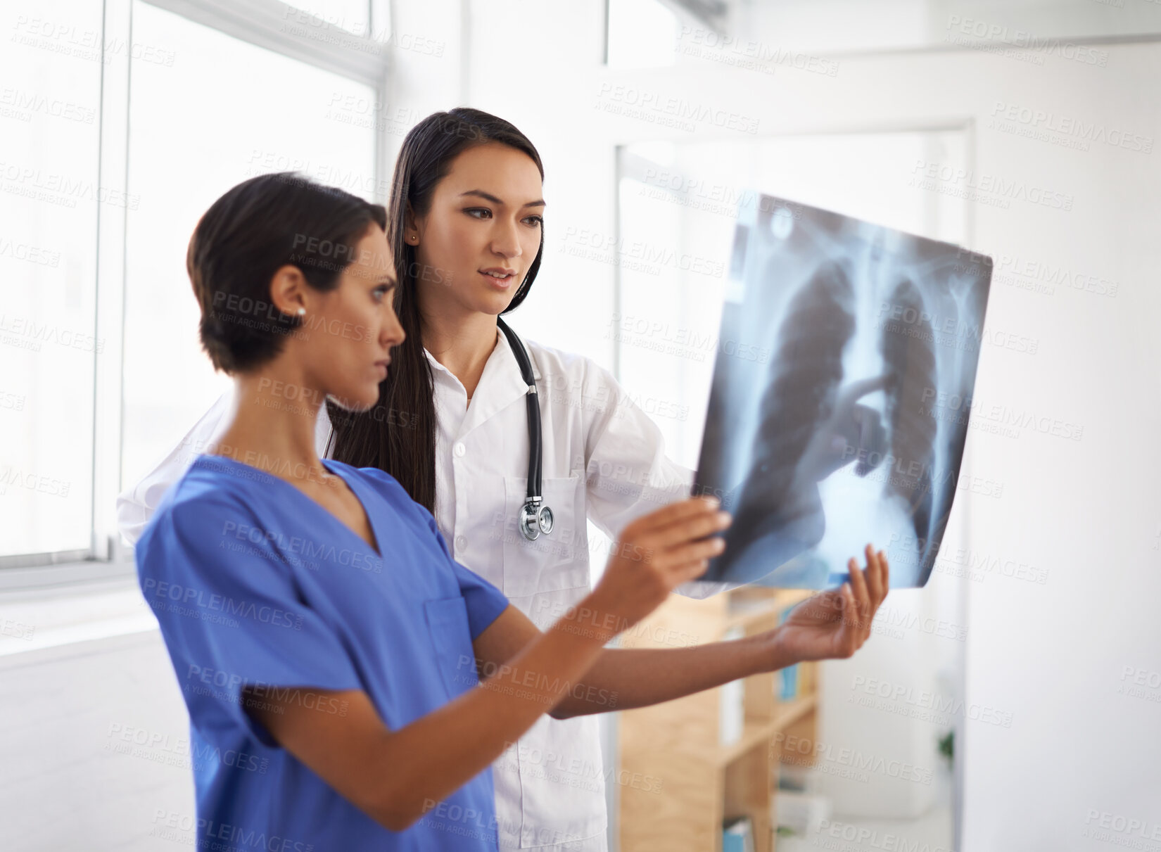 Buy stock photo Radiology, x ray or doctors with results in hospital, medical facility or clinic for lung exam or health. Women, people or healthcare workers with document, research or analysis of respiratory system