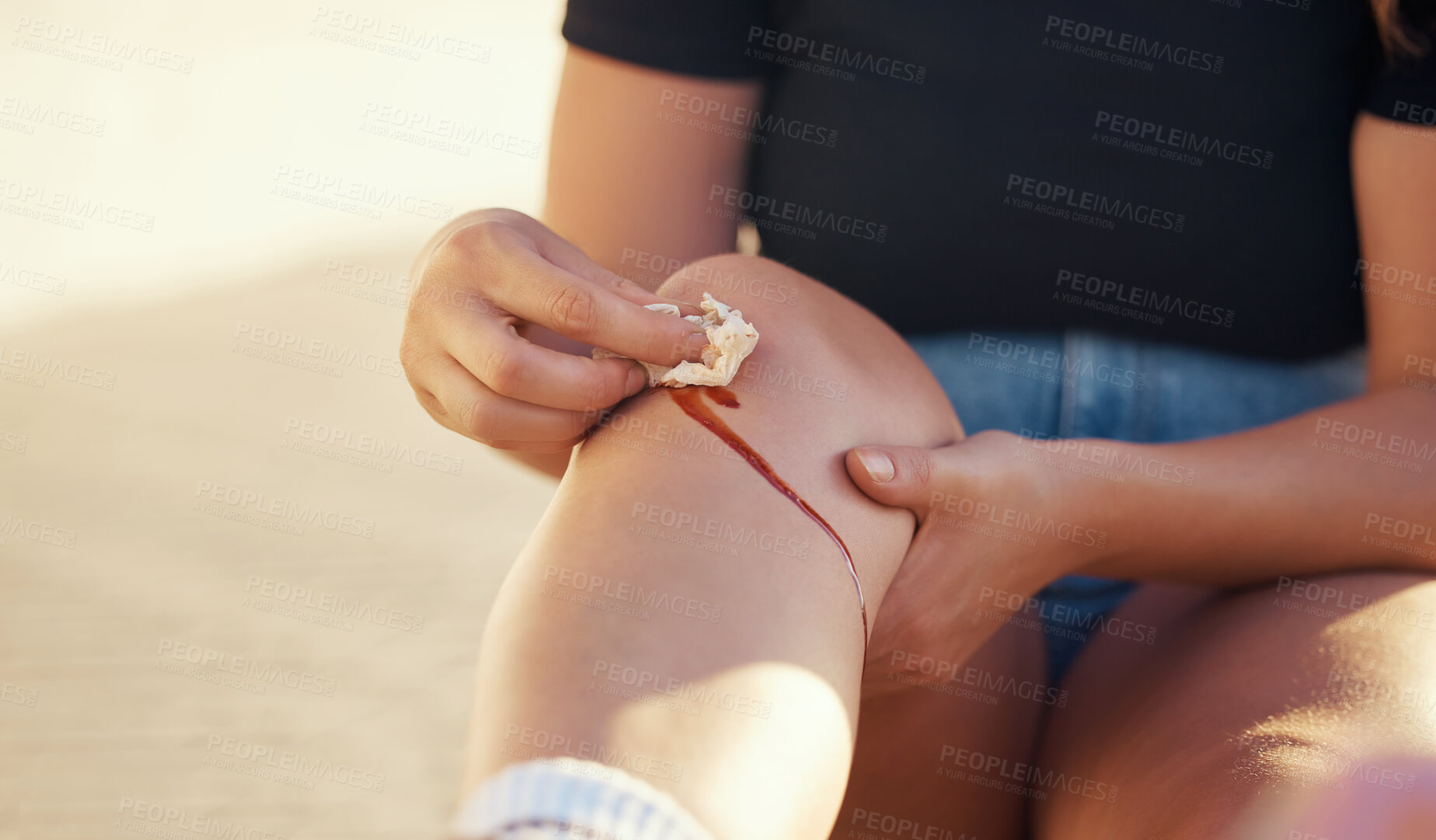 Buy stock photo Knee injury and person cleaning blood wound with tissue to stop bleeding for healing and recovery. Self care hygiene after accident with torn and sore skin on leg for infection prevention.