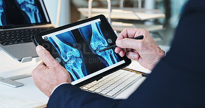 Buy stock photo Hands, bone scan and tablet screen for patient record for healthcare or examination with xray. Doctor, male person and technology for MRI results, injury or illness as orthopedic or medical condition