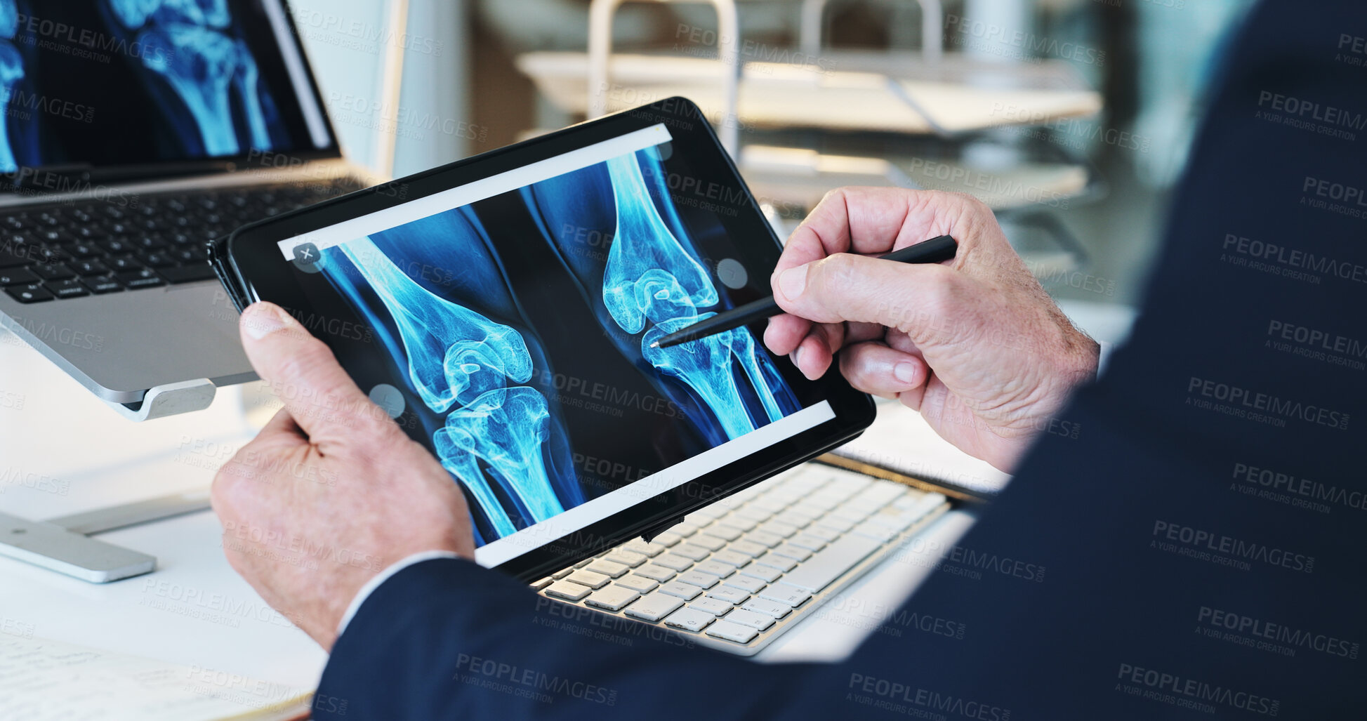 Buy stock photo Hands, bone scan and tablet screen for patient record for healthcare or examination with xray. Doctor, male person and technology for MRI results, injury or illness as orthopedic or medical condition