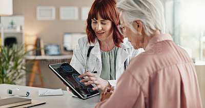 Buy stock photo Tablet, doctor and senior woman with brain scan results, consultation or healthcare discussion in office. Advice, elderly patient and medical professional with MRI on digital app for Alzheimer exam