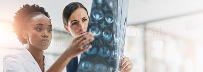 Buy stock photo Brain scan, doctors and medical with women in hospital for consulting, diagnosis or results. Feedback, healthcare and MRI with professional medicine people in neurology clinic for advice or help