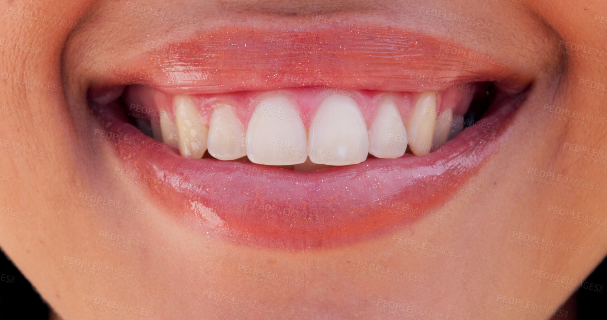 Buy stock photo Happy, beauty and lips of woman with smile for confidence, pride and joy outdoors for dental wellness. Facial expression, cheerful and closeup of person with gloss for health, hygiene and oral care