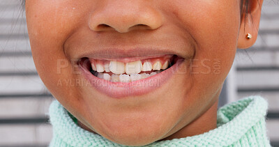 Buy stock photo Smile, health and closeup of child in city for happiness, orthodontist and teeth cleaning. Pride, wellness and oral hygiene with zoom of mouth of person in outdoor for confidence, gum care and dental