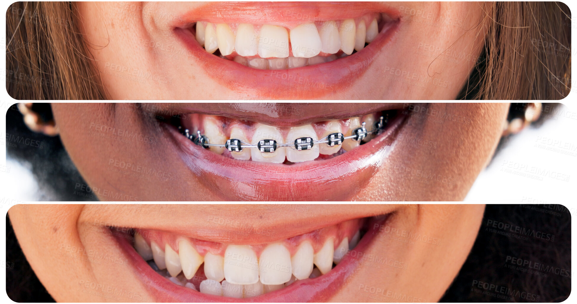 Buy stock photo Mouth, diversity and smile with collage of people in city for happy, dental and teeth cleaning. Pride, wellness and oral hygiene with closeup of lips with facial expression for confidence and braces