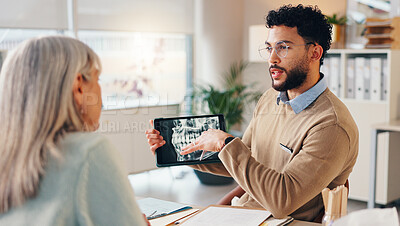 Buy stock photo Mature woman, doctor and tablet with dental scan for consultation, medical services and orthodontist. People, technology and patient in hospital for appointment, veneers and healthcare with diagnosis