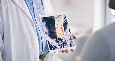 Buy stock photo Doctor, patient or tablet with x ray in clinic for bone tumor, infection or spine fracture results. Hospital, medical worker or consulting person with healthcare diagnosis, screen or ct scan advice