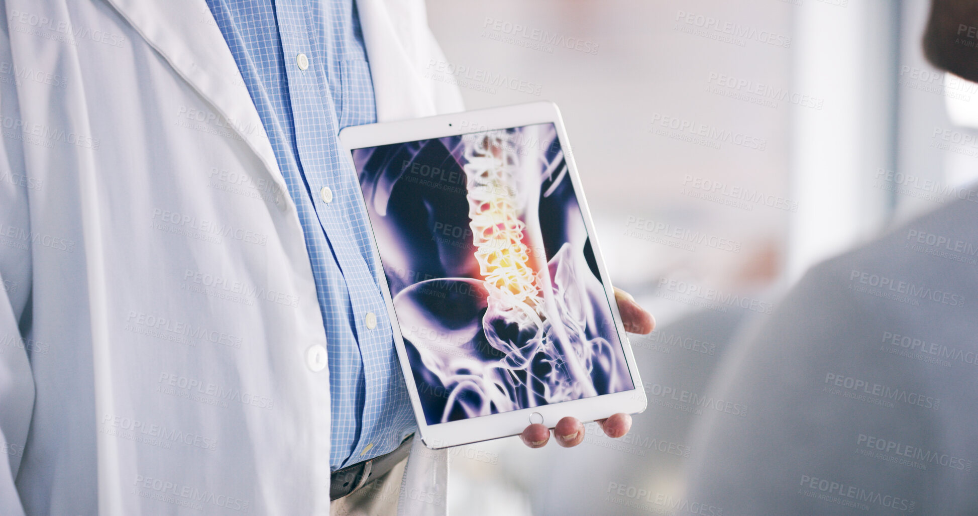 Buy stock photo Doctor, patient or tablet with x ray in clinic for bone tumor, infection or spine fracture results. Hospital, medical worker or consulting person with healthcare diagnosis, screen or ct scan advice