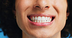 Person, teeth and mouth with smile for dental clean, hygiene or oral and gum care treatment. Closeup, lips and tooth whitening with dentist for cavity or plaque removal on a blue studio background