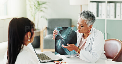 Buy stock photo Appointment, healthcare or x ray with doctor and patient in office of hospital for consulting. Conversation, medical or radiology with mature medicine professional and woman in clinic for diagnosis