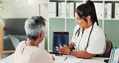 Buy stock photo Medical, tablet screen or x ray with doctor and patient in office of hospital for consulting. Healthcare, radiology or results with medicine professional and mature woman in clinic for treatment
