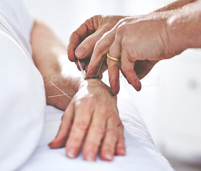 Buy stock photo An unrecognizable woman getting needles inserted into her hand during an acupuncture session. Closeup of patient getting alternative therapy for medical treatment