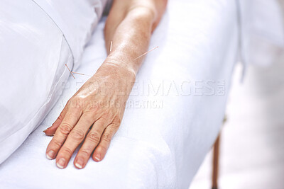 Buy stock photo An unrecognizable woman getting needles inserted into her hand during an acupuncture session. Closeup of patient getting alternative therapy for medical treatment