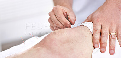 Buy stock photo An unrecognizable woman getting needles inserted into her knee during an acupuncture session. Closeup of patient getting alternative therapy for medical treatment