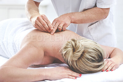 Buy stock photo An unrecognizable woman getting needles inserted into her back during an acupuncture session. Patient getting alternative therapy for medical treatment