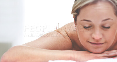 Buy stock photo A young woman getting needles inserted into her back during an acupuncture session. A patient getting alternative therapy for medical treatment