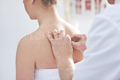 Buy stock photo An unrecognizable woman getting needles inserted into her back during an acupuncture session. Closeup of patient getting alternative therapy for medical treatment