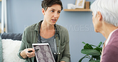 Buy stock photo Doctor, patient and consultation with tablet for brain scan, cancer diagnosis with CT results and healthcare. Explain MRI, treatment plan and surgeon with senior woman for neurology update on screen