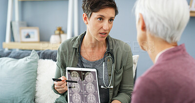 Buy stock photo Doctor, patient and health with tablet for brain scan, cancer diagnosis with CT results and consultation. Explain MRI, treatment plan and surgeon with senior woman for neurology update on screen