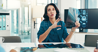 Buy stock photo Brain, x ray and neurologist with woman in meeting for skull injury, research or tumor diagnosis in hospital. Talking, neurology or healthcare medical people with MRI results, xray scan and teamwork