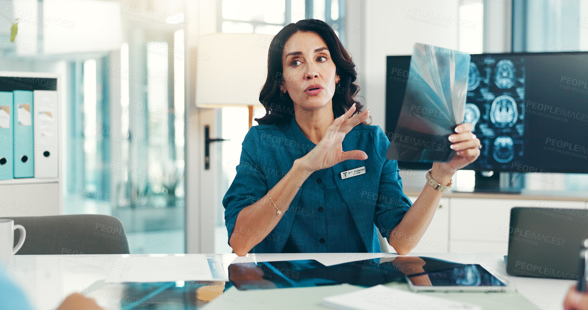 Buy stock photo Brain, x ray and neurologist with woman in meeting for skull injury, research or tumor diagnosis in hospital. Talking, neurology or healthcare medical people with MRI results, xray scan and teamwork