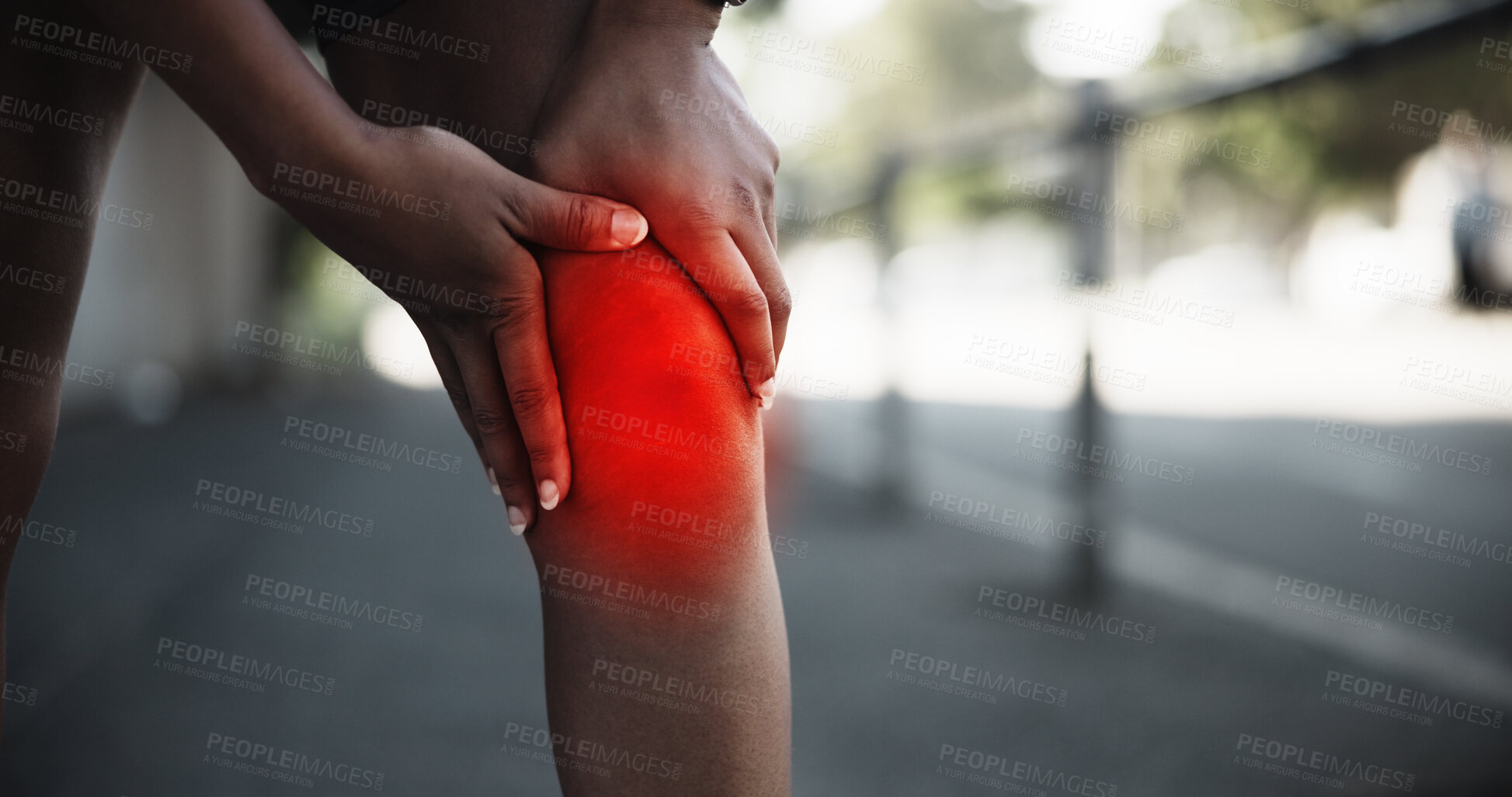 Buy stock photo Hands, knee pain or exercise overlay in city, muscle cramps or tension for fitness mistake. Fibromyalgia, discomfort and female athlete for tendon tear, leg fracture or red inflammation glow outdoor