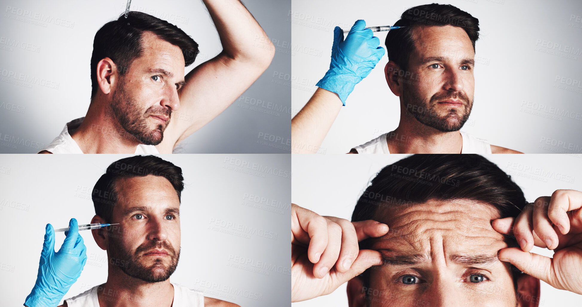 Buy stock photo Anti aging, needle and man in collage for skincare for filler injection, hair growth or aesthetic treatment. Collagen benefits, wrinkles or studio with alopecia cosmetics or serum on white background