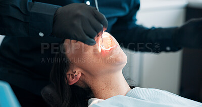 Buy stock photo Hands, light and mouth of patient with dentist in office for checkup, operation or surgery. Appointment, dental hygiene or healthcare with medicine professional and woman at clinic for oral exam
