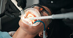 Medical, mouth or ultraviolet with patient and dentist in office for appointment, checkup or operation. Dental, filling or hygiene with medicine professional and woman at clinic for healthcare