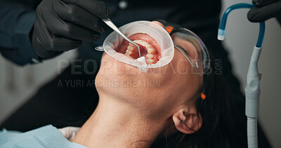 Buy stock photo Appointment, filling and mouth of patient with dentist in office for checkup or operation. Healthcare, oral procedure or surgery with dental professional and woman at clinic for tooth repair