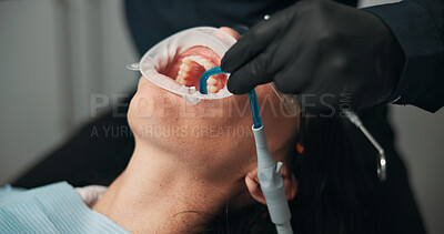 Buy stock photo Hands, medical procedure and mouth of patient with dentist in office for checkup or surgery. Dental hygiene, filling or healthcare with medicine professional and woman at clinic for oral exam