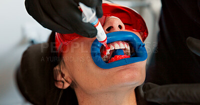 Buy stock photo Appointment, medical or tooth cleaning with patient at dentist for checkup or mouth operation. Dental hygiene, healthcare or oral procedure with medicine professional and woman closeup at clinic