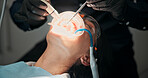 Hands, man or patient with mouth procedure in dental clinic for help, veneers or medical surgery. Appointment, operation or client in oral exam for dentistry, teeth whitening or cosmetics treatment